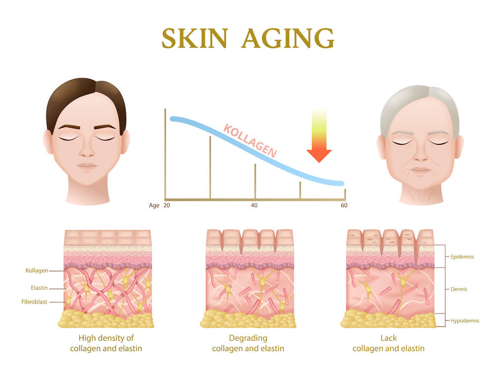 胶原蛋白会随着年龄增加而流失，皮肤因此失去弹性、水分与光泽。